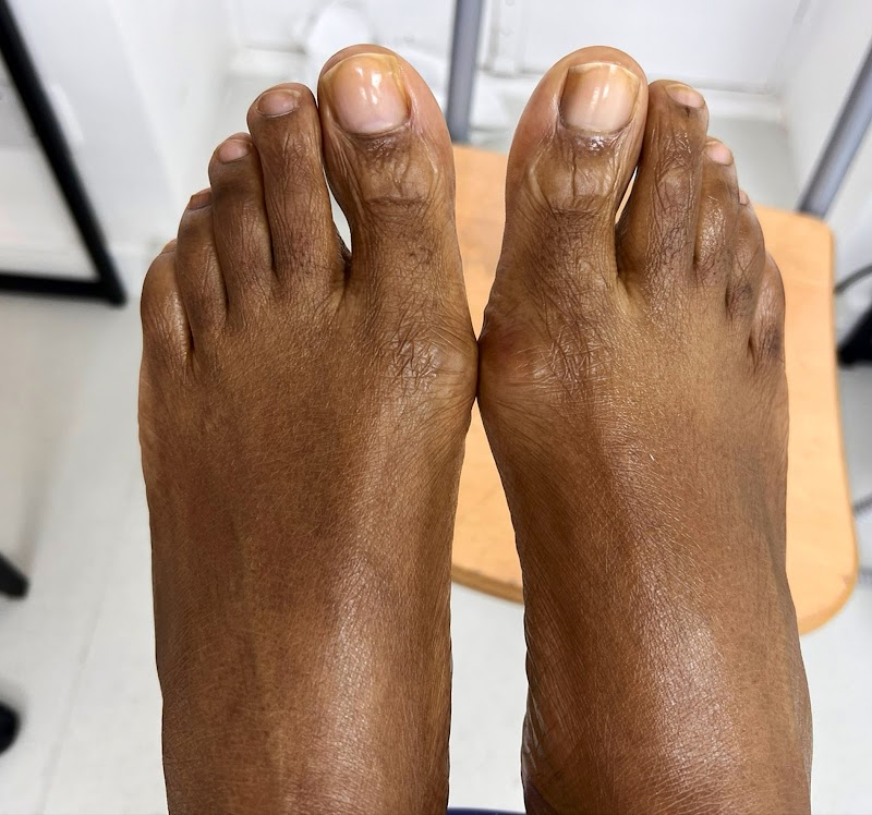 French Tips at Chelsea Pedicure in London